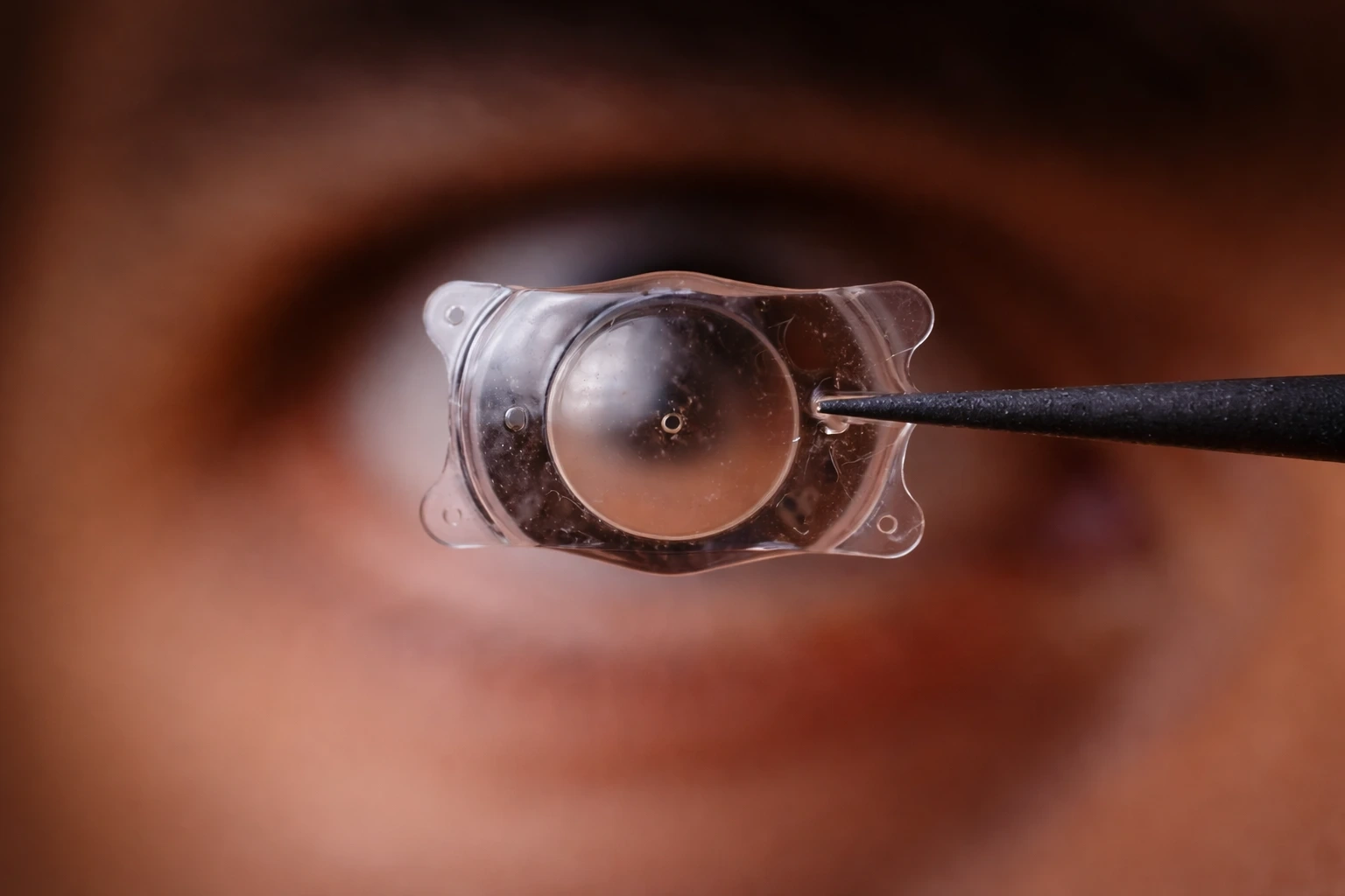 ICL - Implantable Contact Lens
